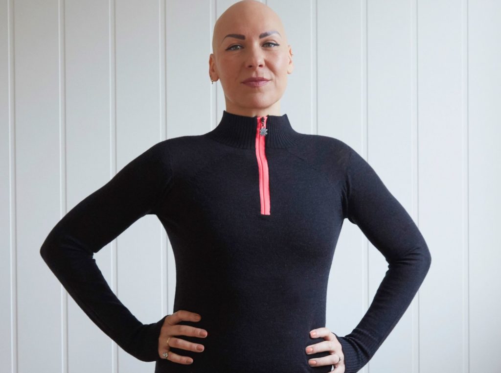 Octavia proudly standing with no wig on. Showing she is bald from her Alopecia