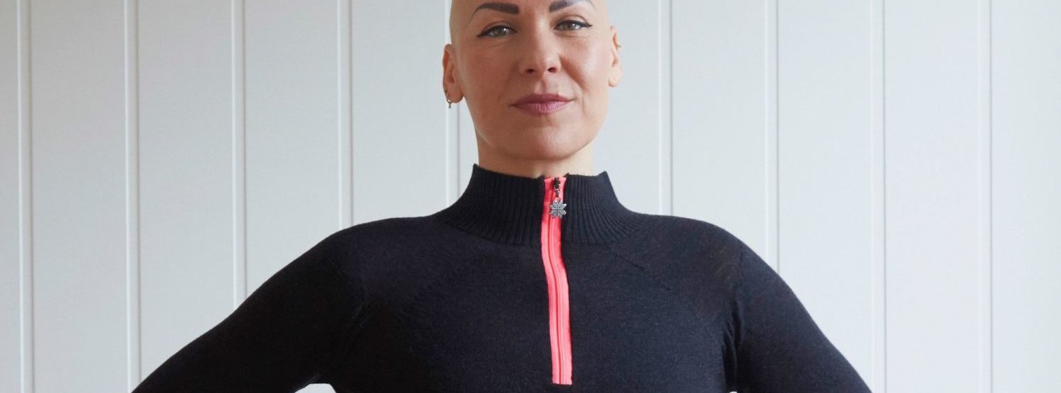 Octavia proudly standing with no wig on. Showing she is bald from her Alopecia