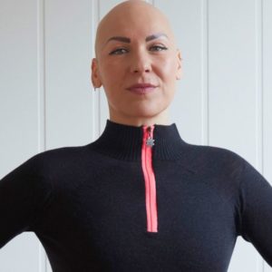 Octavia proudly standing with no wig on. Showing she is bald from her Alopecia