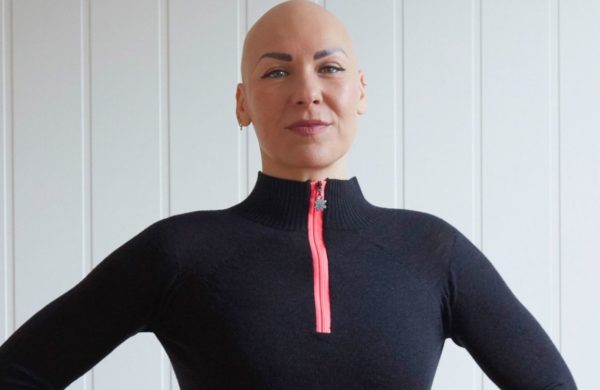 Octavia proudly standing with no wig on. Showing she is bald from her Alopecia